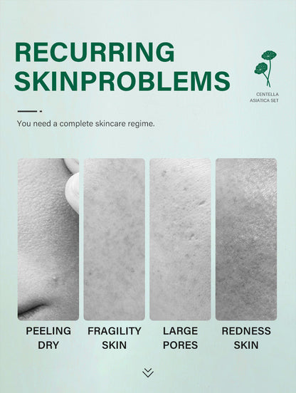 Private Label Skin Repair Centella Skin Care Kit Soothes Acne Face Care Centella Asiatica Extract Natural Facial Skin Care Set - Modernrush.us